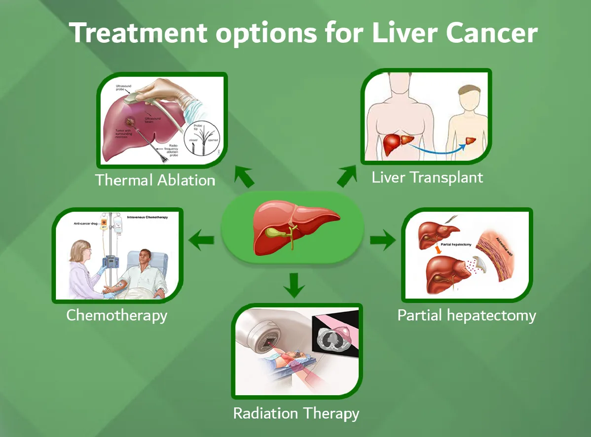 Liver Cancer Treatments- Surgery, Chemotherapy, Radiation and Biologicals